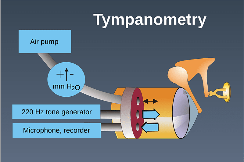 Diagram of a tympanometry, or tympanic membrane, test. Courtesy of Wikimedia Commons/Scott Martin.