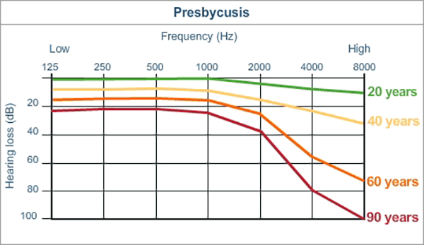 Graph showing presbycusis, or the normal aging of the ear, according to age. From the cochlea.eu website.