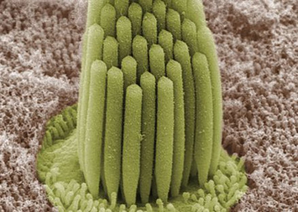 Stereocilia of the frog inner ear. We couldn't get an image of human stereocilia, but we're told our editor's resemble these closely. Courtesy of Wikimedia Commons/Bechara Kachar/public domain.